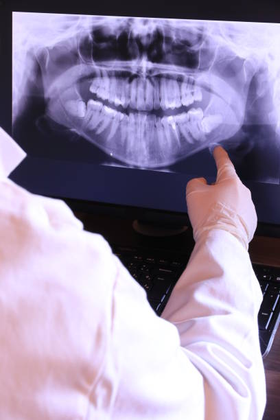 Best Emergency Dental Care for Broken or Chipped Teeth in Van Wert, OH
